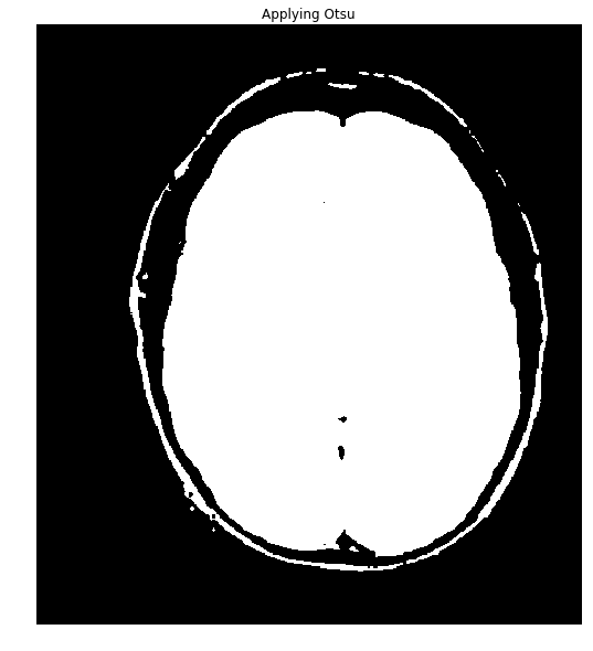 Tresholded brain+skull