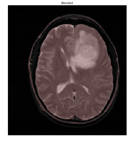 Mask overlaid on brain+skull