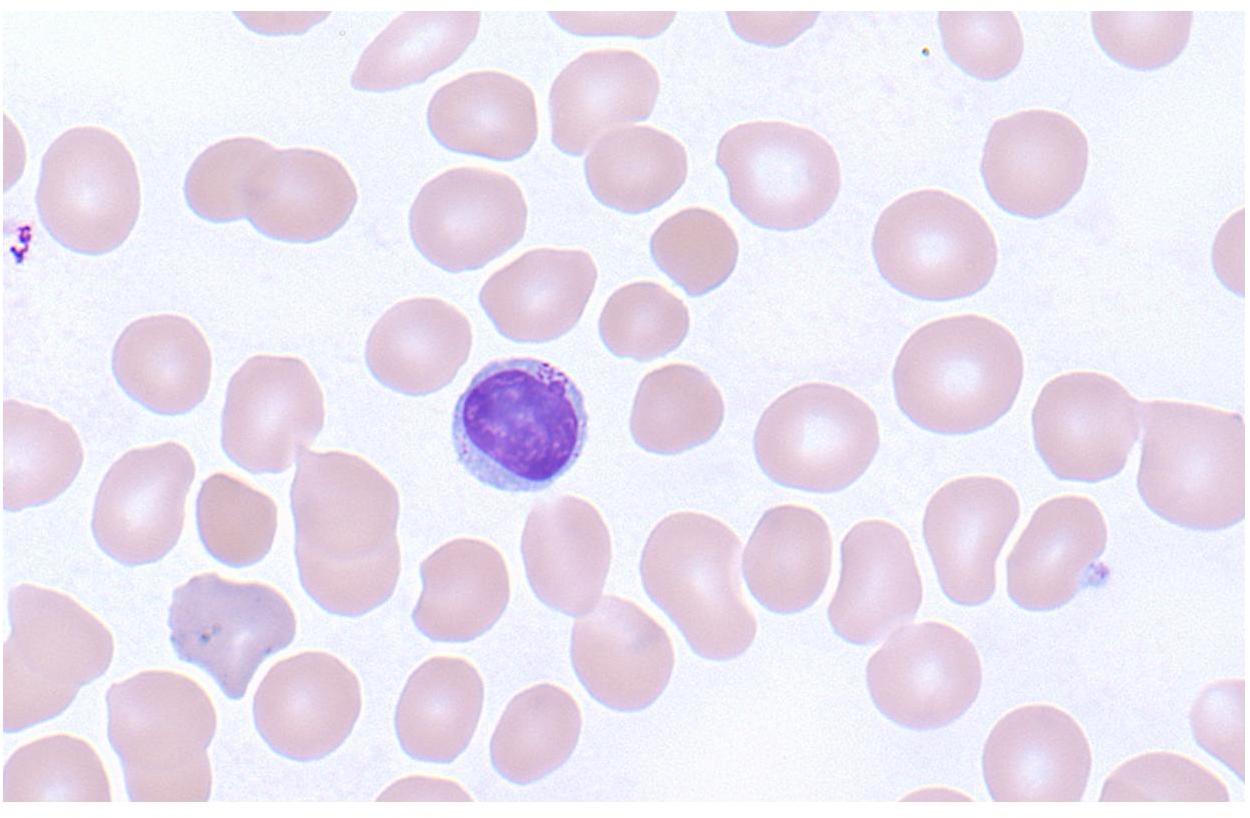 Tresholded grayscale cells