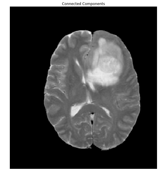 Brain extracted with connected components