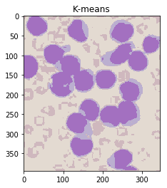 K-means labeled image with colours