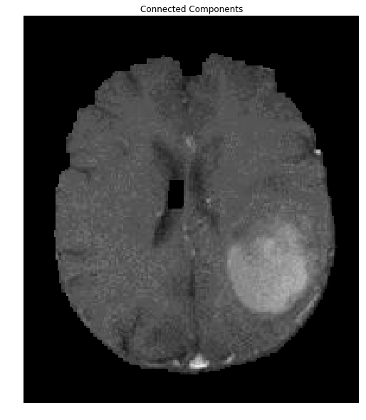 Second brain with better mask